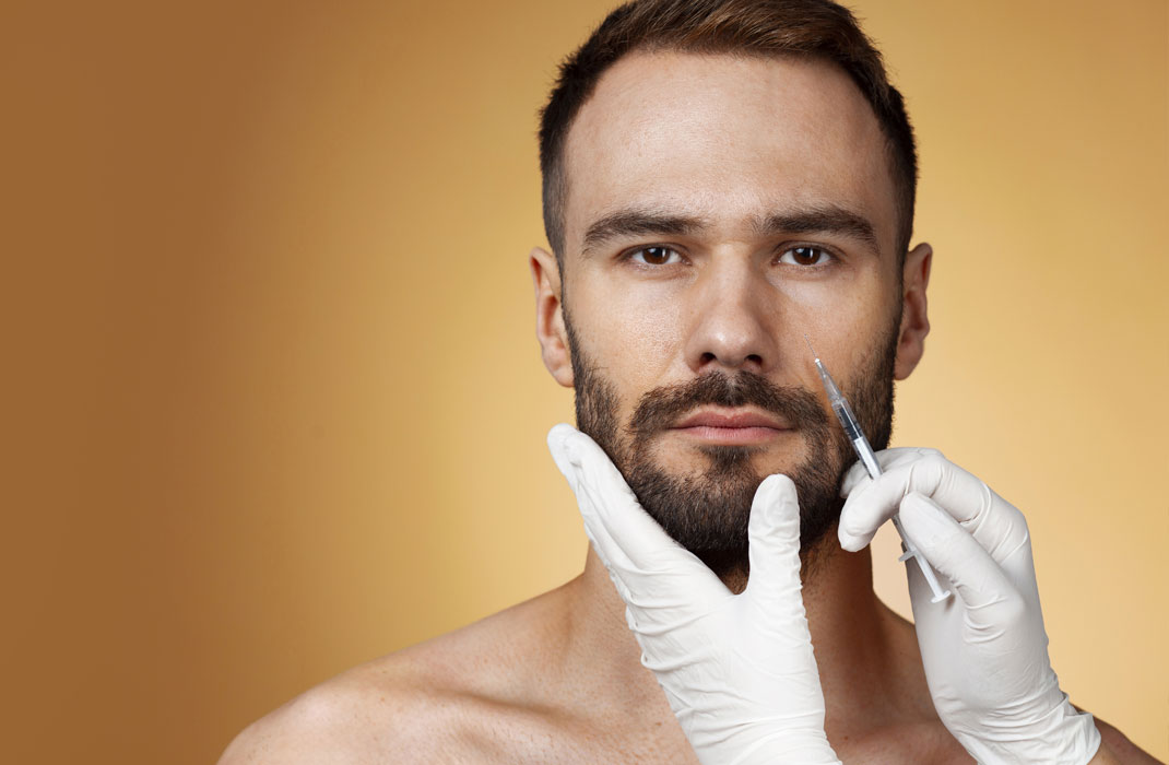 Beard Transplant