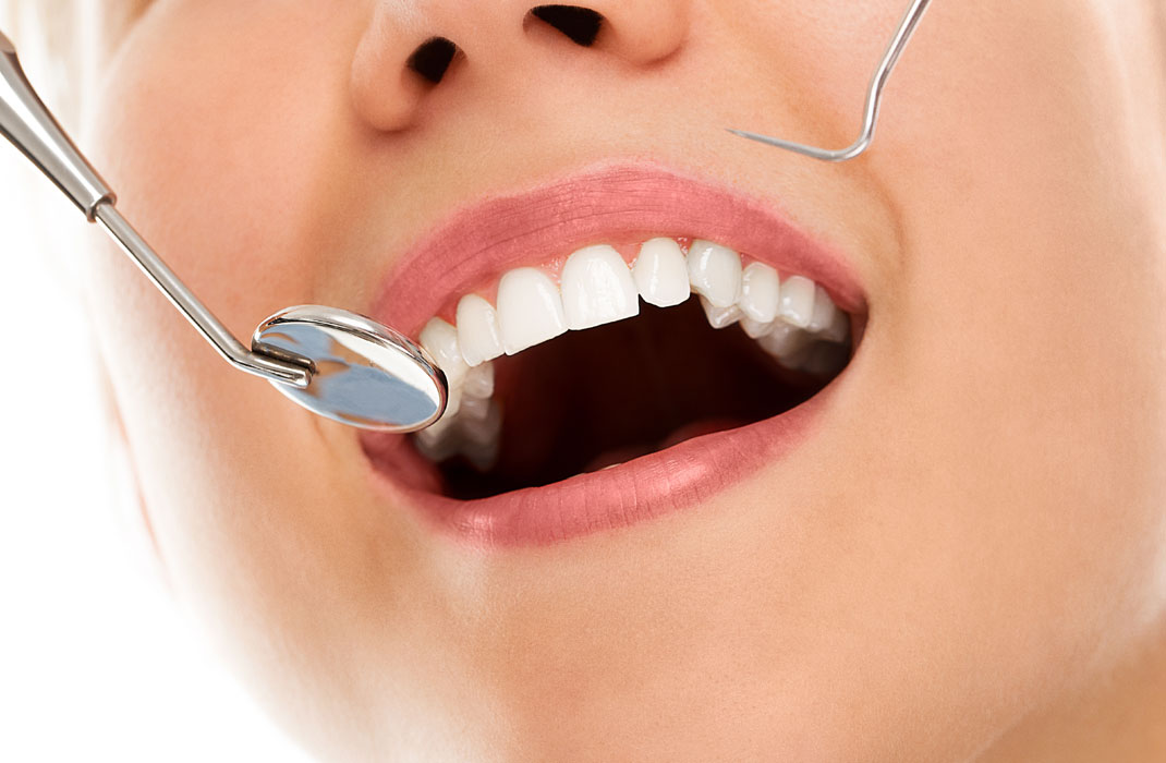 Why Should You Consider Dental Aesthetics?